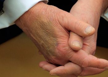 White House explains bruise on Trump’s hand seen during Macron meeting