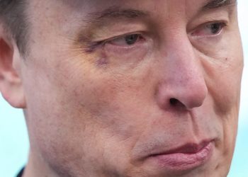 Elon Musk sports black eye at farewell presser in Oval Office: ‘Horsing around with little X’